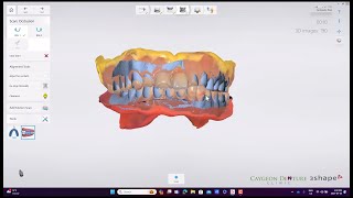 Reference Denture Intraoral Scans [upl. by Malliw505]