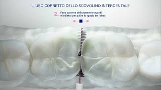 Interprox Come Usarlo in 3 semplici passi [upl. by Oberheim]