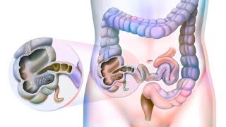 Large intestine  Caecum amp Appendix Part1 [upl. by Maloy365]