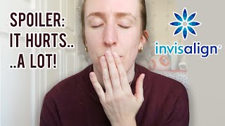 SURVIVING MY FIRST WEEK OF INVISALIGN  Watch me suffer for 18 mins It gets easier I promise [upl. by Atipul]