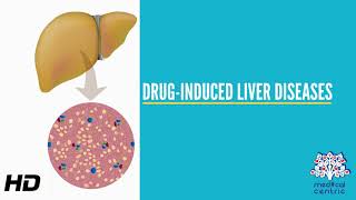 DrugInduced Liver Disease Causes Signs and Symptoms Diagnosis and Treatment [upl. by Eserehs]