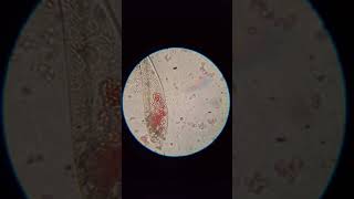 Cute Little Paramecium Eating Congo RedDyed Yeast [upl. by Attesoj]