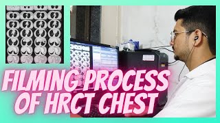 Filming process of HRCT CHEST PLAIN Scan  radiologytechnologist ctscan radioimaging [upl. by Hnaht662]