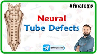 Neural Tube Defects Anatomy [upl. by Koenig]