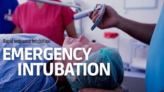 Emergency Intubation RSI in ER step by step approach [upl. by Harolda663]