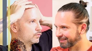 MAN BUN nach 2 Haartransplantationen vs Buzz Cut – Mein ehrliches Fazit  GREY YOUNG [upl. by Teplica]