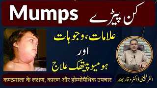 Mumps کن پیڑے कण्ठमाला का रोग Homeopathic Treatment Symptoms by DrWaqar Bhutta  Urdu  Hindi [upl. by Ineslta]