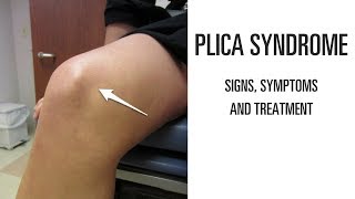 Plica syndrome Signs symptoms and treatment of this uncomfortable knee pain [upl. by Piscatelli]