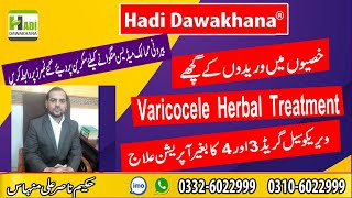 Varicocele Symptoms and Treatment  Varicocele Treatment without Surgery  Varicocele kya hai [upl. by Aiyn]