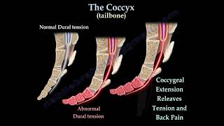 Coccydynia  coccyx pain coccyx pain causes diagnosis and treatment [upl. by Oirasec]