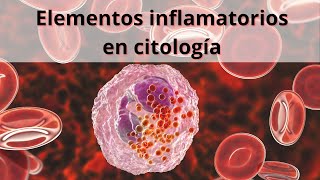 Elementos inflamatorios en citología Glóbulos blancos Leucocitos [upl. by Acinomed]