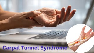 Carpal tunnel syndrome  Diagnosis and Treatment [upl. by Yllut420]