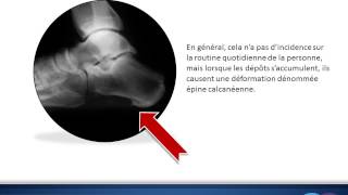 Origine de lépine de Lenoir ou lépine calcanéenne [upl. by Ycart]