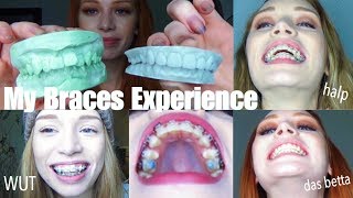 3 YEARS OF BRACES IN UNDER 30 MINS  VLOGstyle experience  transformation quotglowupquot [upl. by Babara]