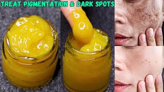 Best Cream to treat pigmentation dark spots and acne scars  Skin Brightening Cream [upl. by Alansen]