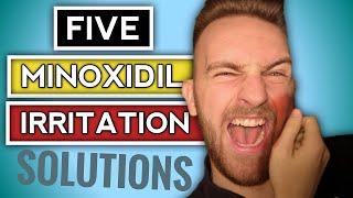 Minoxidil Dry Skin amp ITCHY Rash Solution  FIVE FIXES  Minoxidil Beard Side Effects [upl. by Hoon743]