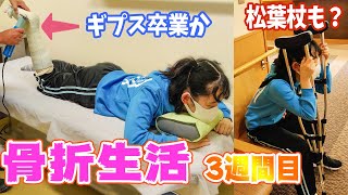 骨端線の骨折！ギプスが外れた？でも新しい医療器具登場！松葉杖はまだまだ必要なのです [upl. by Jeramey495]