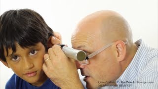 Ear Pain 5 Otoscope Examination [upl. by Eelannej556]