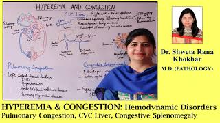 HYPEREMIA amp CONGESTION Pulmonary Congestion  CVC Liver  Congestive Splenomegaly [upl. by Iztim]