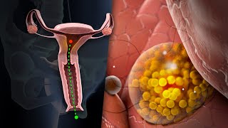 Así es el proceso de la menstruación [upl. by Sicular306]