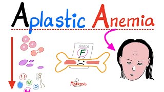 Aplastic Anemia  All you need to know  Definition Causes Symptoms Diagnosis amp Treatment [upl. by Stepha611]