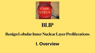 BLIP Benign Lobular Inner Nuclear Layer Proliferations I Overview [upl. by Booma721]