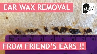 Ear Wax Removal from FRIENDS Ear   372 [upl. by Madelene446]