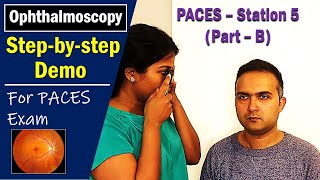 PACES UK Station 5 OphthalmoscopyFundus Exam Stepbystep Howto Guide [upl. by Ayanet]