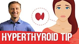 Hyperthyroidism Symptoms amp Conditions  Graves  Best Tips – DrBerg [upl. by Nwahshar]