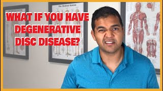 What Is Degenerative Disc Disease amp What To Do About It  El Paso Manual Physical Therapy [upl. by Rosner]