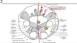 4 Closed medulla  motor decussation [upl. by Kuth]