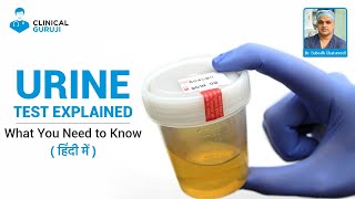 Urine Test Explained What You Need to Know [upl. by Septima]