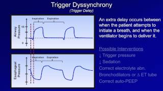 Pathologic Complications Mechanical Ventilation  Lecture 11 [upl. by Ahsienom]