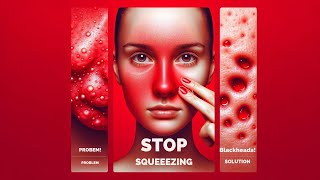 The Truth About Squeezing Blackheads [upl. by Gaudet]