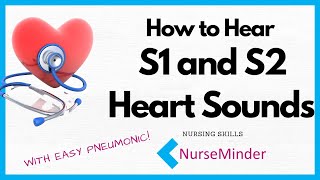 How to Hear S1 and S2 Heart Sounds [upl. by Tolman]