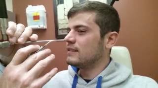 Septoplasty  Nasal Splint Removal  Post Surgery [upl. by Schrader]