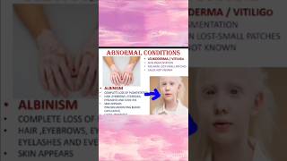 Albinismskinclass9th icseexam9thbio [upl. by Goodspeed814]