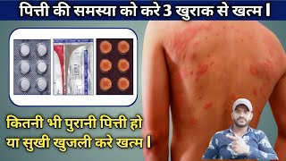 पित्ती हो या सुखी खुजली सिर्फ 3 खुराक में करे खत्मurticaria treatment [upl. by Elocn351]