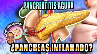 Todo sobre Pancreatitis Aguda en 15 minutos fácil y rápido [upl. by Hsemin907]