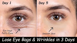 Remove Under Eye Wrinkles  Puffy Eyes amp Dark Circles amp Under eye cream for dark circles ampWrinkle [upl. by Okajima]