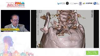 Neurosurgical virtual reality simulation in craniovertebral junction lesions [upl. by Crim]