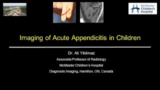 Acute Appendicitis [upl. by Westfahl695]