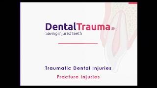 1 Traumatic Dental Injuries Part 1 Fracture Injuries Type 1 Infractions [upl. by Cleres]