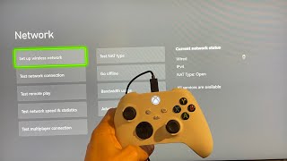 Xbox Series XS How to Fix Cannot Obtain IP Address Tutorial Network Settings 2023 [upl. by Leinoto]