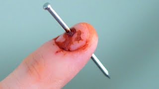 NAIL IN FINGER [upl. by Sylas]