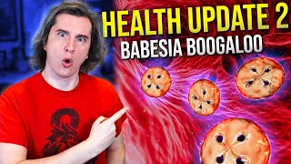 Health Update 2 Babesia Boogaloo [upl. by Inaleon369]