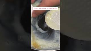 woosh acne bye bye read comments ytshorts skincareremedies YouTube homemade skin routines [upl. by Duvall]