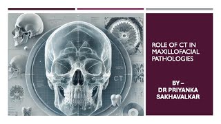 Role of CT in Dental and Maxillofacial imaging [upl. by Adla793]