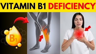 7 Unusual Vitamin B1 Deficiency Symptoms Thiamine [upl. by Vories24]