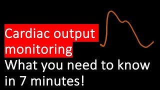 Cardiac Output Monitoring Pulmonary artery catheter Oesophageal doppler pulse pressure variation [upl. by Tansy881]